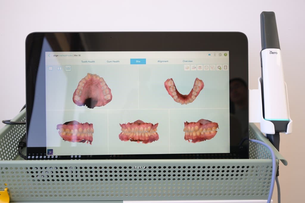 An intraoral scanner displaying a digital model of teeth